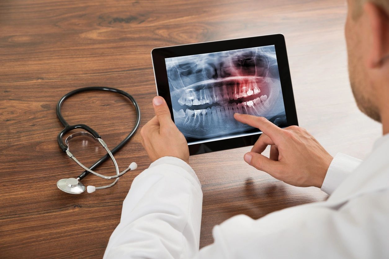 dental dental